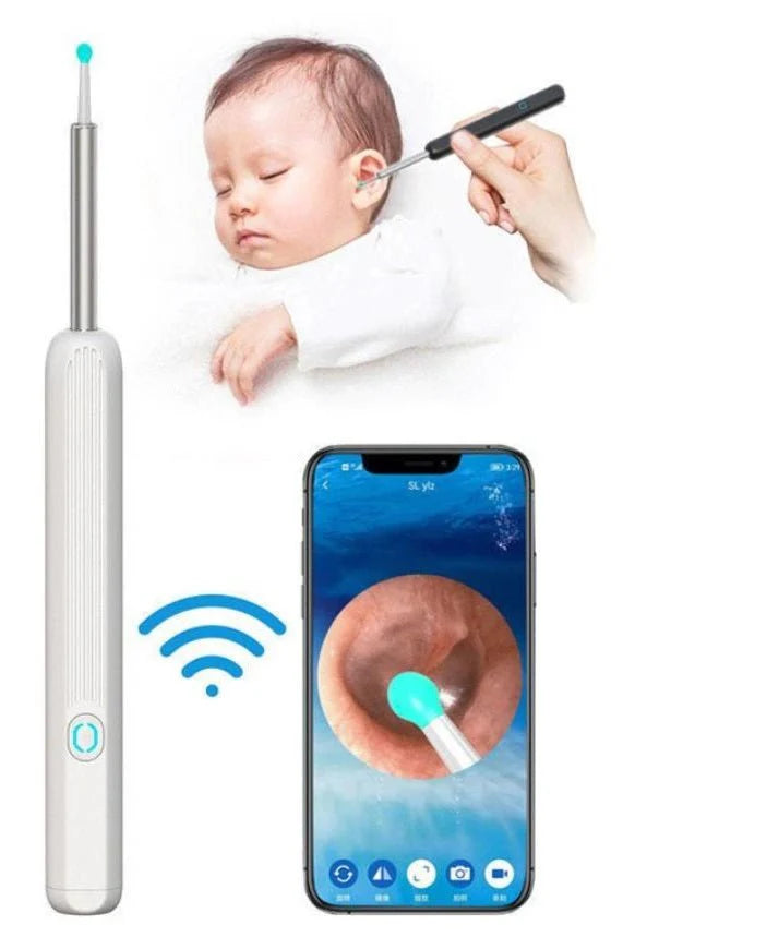Earwax Removal Kit – Reusable Ear Cleaning Tool Set with Soft Silicone Tips