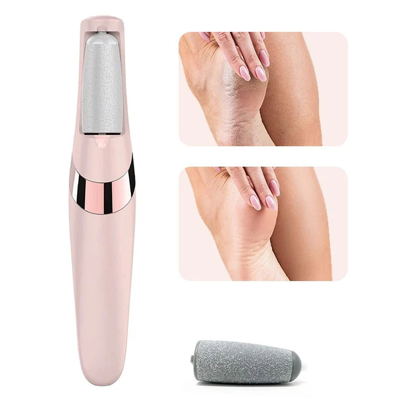 Electric Pedicure Foot File Callus Remover – Rechargeable Foot Care Device