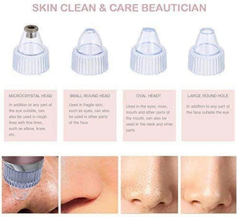 Electric Pore Cleaning Device – Rechargeable Blackhead Remover & Facial Pore Vacuum